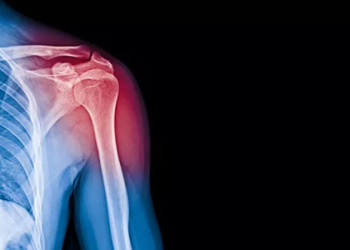 Jangan Sembarangan Lakukan Gerakan Ini atau Terjadi Tendinitis