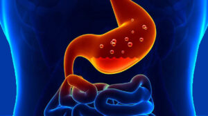 Cara Ampuh Atasi Mag Kambuh!