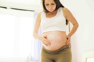 Penyebab Hingga Cara Mencegah Kemunculan Stretch Mark