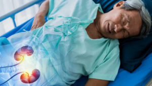 Catat Nih! Ciri Ciri Ginjal yang Sehat dan yang Tidak Sehat