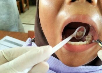 Masalah Kesehatan Gigi Dominasi Keluhan di CKG, Menkes Baru Ngeuh Kalau 50 Persen Puskesmas Tak Ada Dokter Gigi