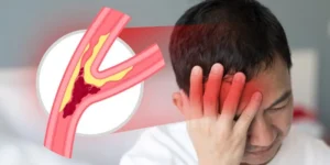 Kenapa Gejala Stroke Sering Terjadi Malam Hari? Begini Penjelasannya