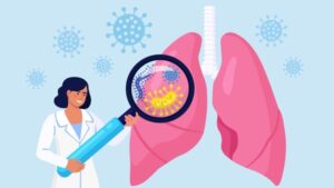 Kasus TBC di Indonesia Raih Peringkat Nomor 2 Terbesar di Dunia