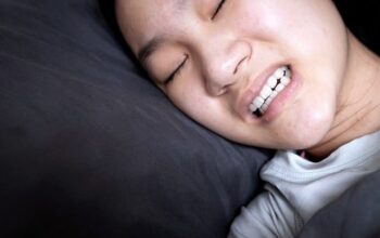 Sering Geretakkan Gigi Saat Tidur? Kenali Bruxism dan Dampaknya bagi Kesehatan