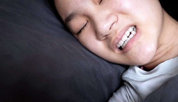 Sering Geretakkan Gigi Saat Tidur? Kenali Bruxism dan Dampaknya bagi Kesehatan