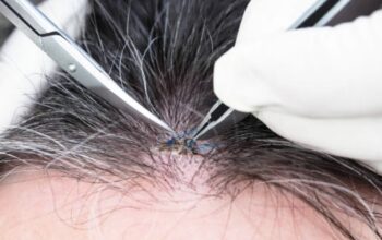 Benarkah Mencabut Uban Bikin Rambut Putih Makin Banyak? Ini Penjelasannya