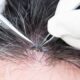Benarkah Mencabut Uban Bikin Rambut Putih Makin Banyak? Ini Penjelasannya